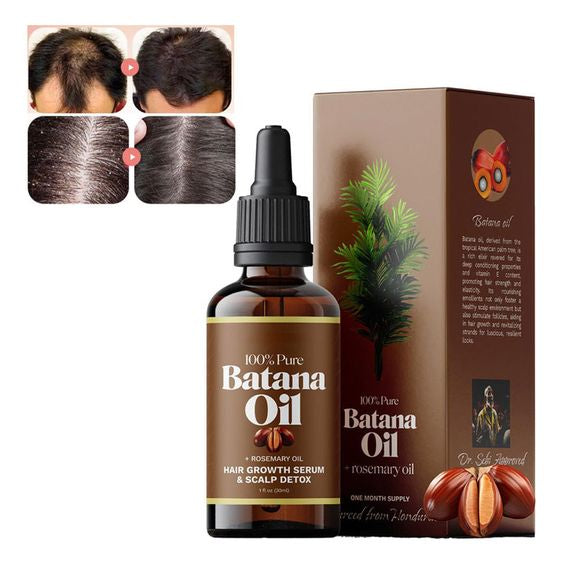 Batana Oil with Rosemary Hair Growth Serum (1 Bottle)