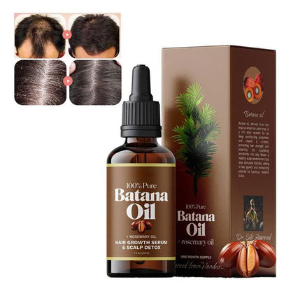 Batana Oil with Rosemary Hair Growth Serum (1 Bottle)
